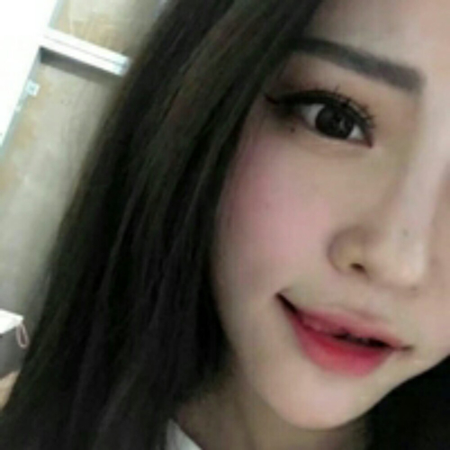 做了隆鼻整形手術(shù)好看多了，分享前后對比果照片~