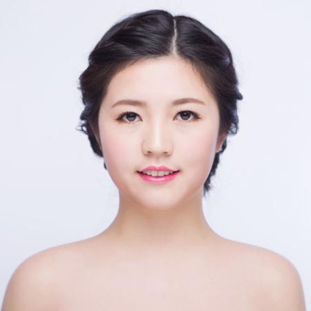 激光去雀斑前后對比果圖片分享，福州海峽林瓏醫(yī)生做的~