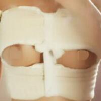 假體隆胸果自然嗎？A到C的隆胸恢復(fù)過程分享