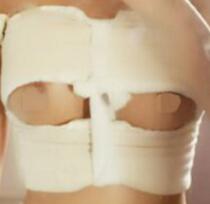 假體隆胸設(shè)計的手術(shù)方案是：腋下切口，進(jìn)口品牌毛面水滴假體，胸部由A豐到C