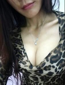 假體隆胸3個月，腋下傷口已經(jīng)基本恢復(fù)