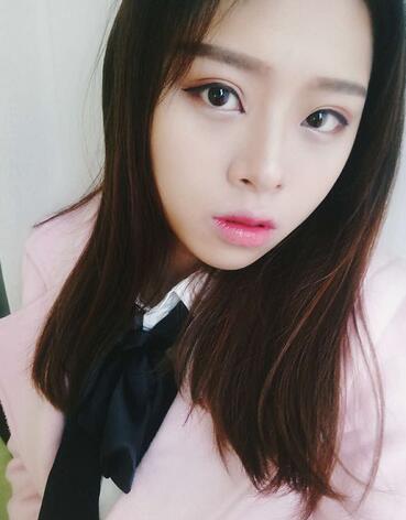 北京熙朵全切雙眼皮1個月恢復(fù)日記