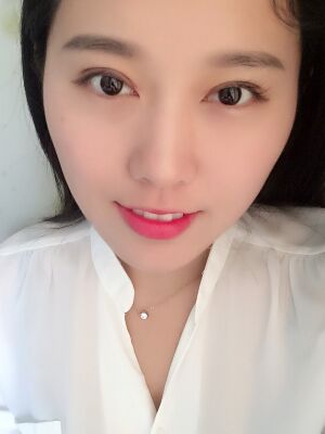 雙眼皮失敗修復(fù)手術(shù)恢復(fù)超自然，看起來(lái)一點(diǎn)都不假