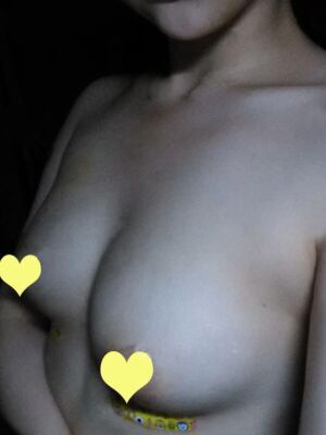 自體脂肪隆胸后胸變得豐滿，腿也細(xì)了很多