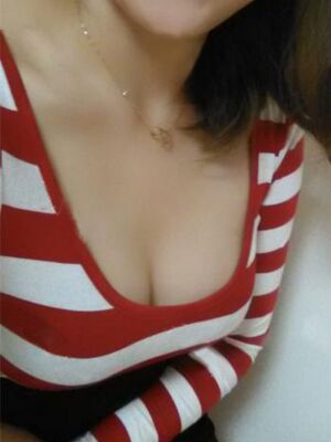 自體脂肪隆胸后胸變得豐滿，腿也細(xì)了很多