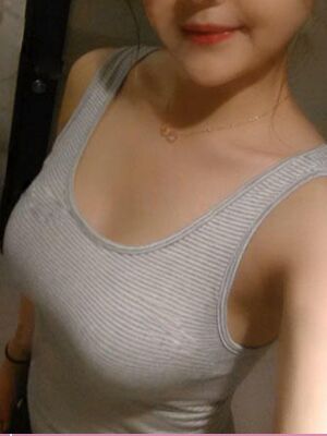 自體脂肪隆胸后胸變得豐滿，腿也細(xì)了很多