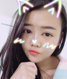 自體脂肪面部填充恢復(fù)