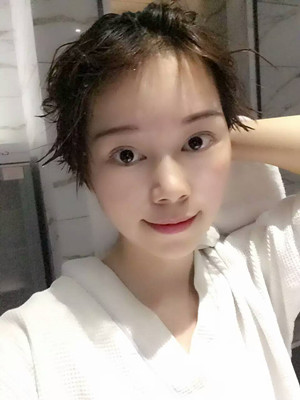 點(diǎn)陣激光祛痘前后過程對(duì)比照片分享，大家來看看果怎么樣