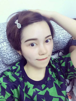 點(diǎn)陣激光祛痘前后過程對(duì)比照片分享，大家來看看果怎么樣