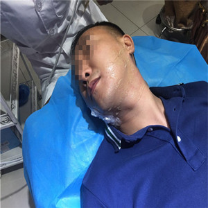 高強(qiáng)度聚焦超聲除掉小細(xì)紋，不再是女人的專*，我也可以擁有!!!