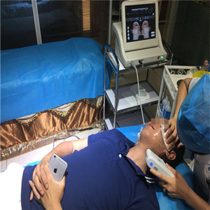 高強(qiáng)度聚焦超聲除掉小細(xì)紋，不再是女人的專*，我也可以擁有!!!