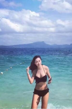 美國麥格假體隆胸術(shù)后恢復(fù)身材超贊