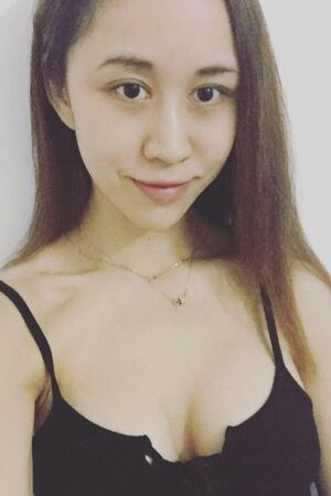 美國麥格假體隆胸術(shù)后恢復(fù)身材超贊