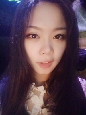 全切雙眼皮手術(shù)，送給自己的成年禮物