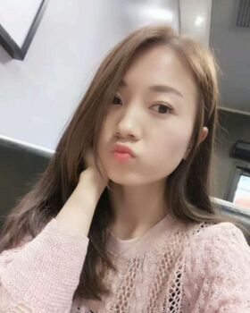 激光去眼袋成好嗎，看看我就知道啦