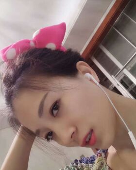 激光去眼袋成好嗎，看看我就知道啦