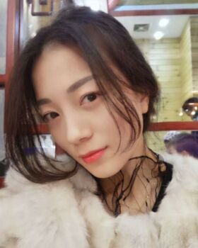 激光去眼袋成好嗎，看看我就知道啦