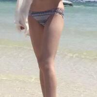 大腿吸脂減肥整形恢復(fù)經(jīng)歷分享，吸脂果不錯