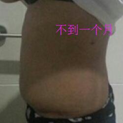 肚子減肥的方法就是吸脂減肥瘦腰腹了，親身經(jīng)歷分享