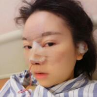 鼻子整形價格10000元，隆鼻手術(shù)過程圖分享
