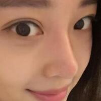 為什么大家覺得隆鼻恐怖，我就做了玻尿酸隆鼻，過程經(jīng)歷分享