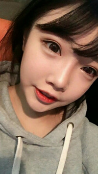 顴骨整形手術后，我也可以擁有精致小臉了