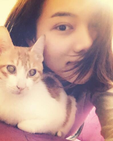 全切雙眼皮恢復(fù)1個(gè)月過程圖