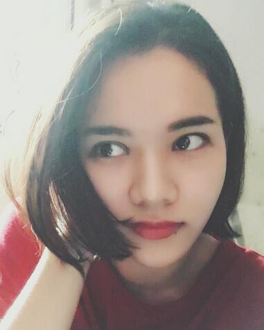 全切雙眼皮恢復(fù)1個(gè)月過程圖