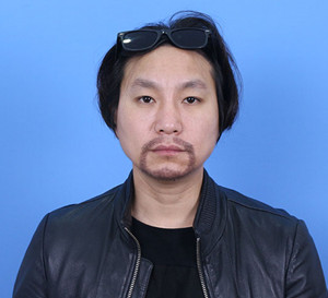 種植胡須手術(shù)前后過程以及對比照片分享