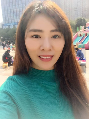 雙眼皮多項(xiàng)整形前后大對比
