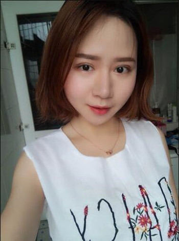 大鼻子就得做隆鼻整形手術(shù)改良 我的果就挺不錯的