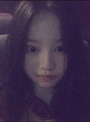 我的隆鼻整形恢復時的那些事