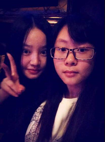 我的隆鼻整形恢復時的那些事