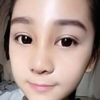 隆鼻整形恢復(fù)日記分享，整形價格8800元