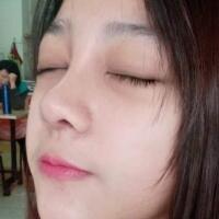 隆鼻整形恢復(fù)日記分享，整形價格8800元