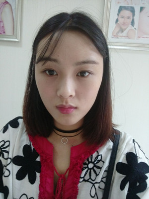 自體脂肪填充全臉，我也可以美美噠