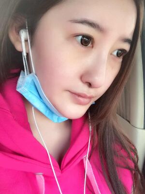 硅膠隆鼻+去眼袋前后對比果十分明X