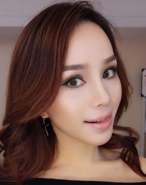 隆鼻整形+硅膠墊下巴前后對比照片給大家瞅瞅