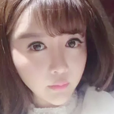 玻尿酸注射隆鼻、自體脂肪豐太陽(yáng)穴跟玻尿酸墊下巴兩個(gè)月果照片~