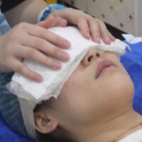 去眼袋手術(shù)多少錢？做了激光去眼袋價(jià)格5800元，恢復(fù)很好