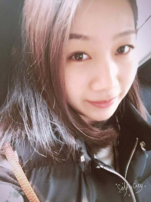 自體脂肪豐面頰，見證我蝶變的過程