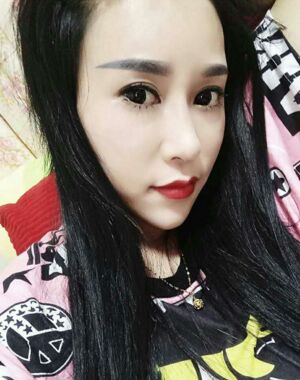 牛永敢做的隆鼻失敗修復(fù)，對比很明X哦~