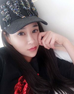 牛永敢做的隆鼻失敗修復(fù)，對比很明X哦~