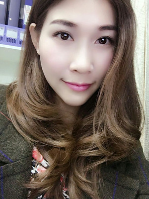 激光祛眼袋2個月，不用手術(shù)就可以變得很年輕哦！