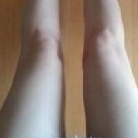 水動力吸脂減肥瘦大腿真實經(jīng)歷，抽脂后對比照片分享