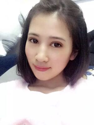 切開雙眼皮恢復(fù)過程，手術(shù)很成功哦