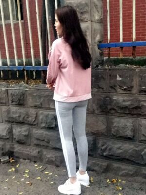 大腿吸脂果超好，腿型好看很多了