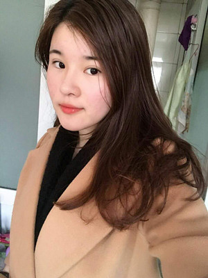 做了詳細(xì)部脂肪填充+雙眼皮+假體隆鼻，來(lái)看看果如何