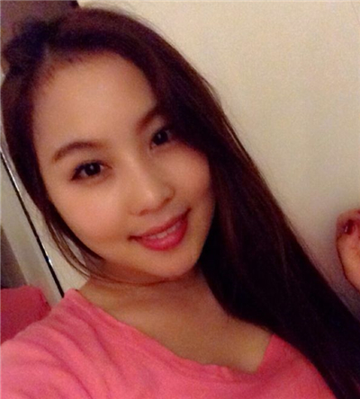 蘇州愛思特呂金陵磨下頜角案例