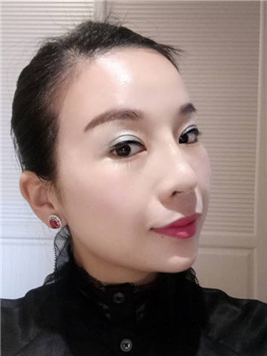 你們來(lái)看看我的面部埋埋蛋白線.提升術(shù)恢復(fù)情況
